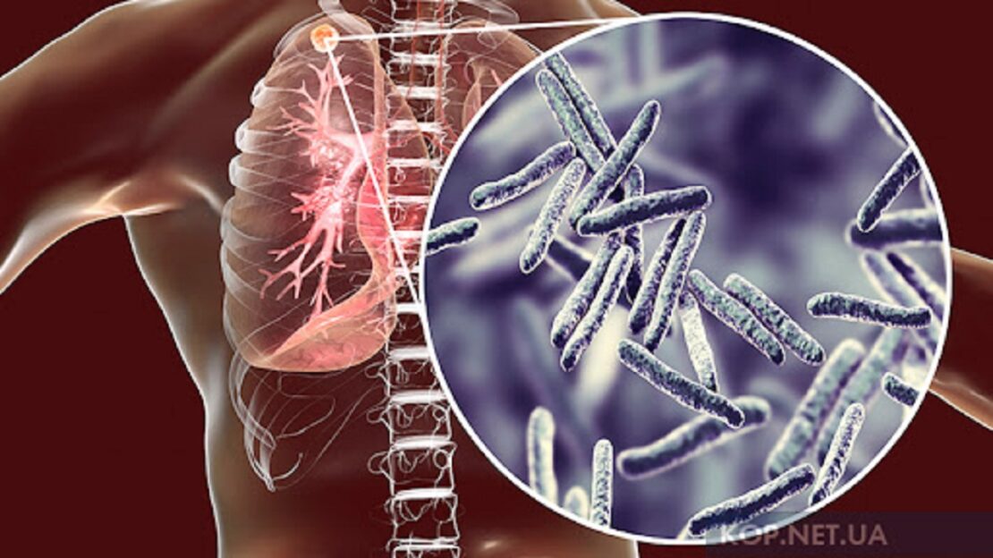 Фото новини