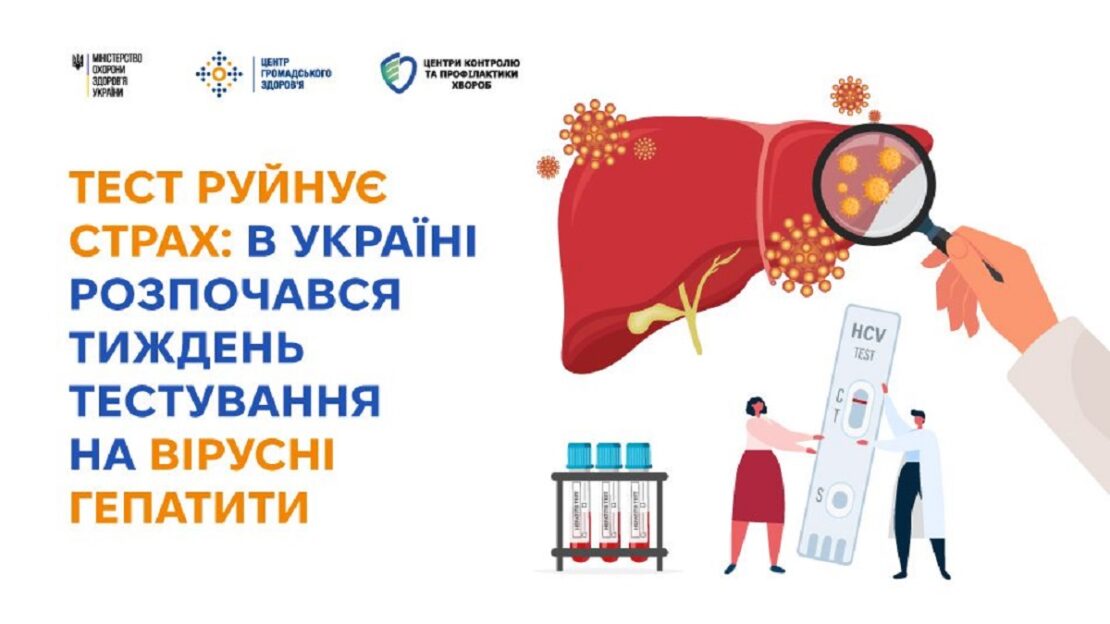 Фото новини